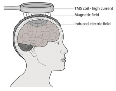 Working-principle-of-TMS-technique-source-nuffieldbioethicsorg Working-principle-of-TMS-technique-source-nuffieldbioethicsorg